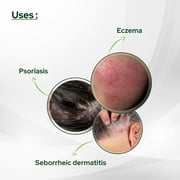 Psoriasis Coal Tar Salicylic Acid for Dry and Itchy Skin-460gm