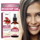 thumbnail image 5 of Fiudx Ofertas Flash Del Día Aceite De Semillas De Rosa Mosqueta, Hidratante Facial, Antienvejecimiento, Masaje Raspado, Rostro, Cabello Y Piel 30Ml, 5 of 6