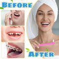 thumbnail image 4 of Cepillo de dientes interdental Lanjue End Tuft, 8 piezas con funda, 4 of 4