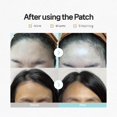 thumbnail image 4 of Labottach Anti Wrinkle Forehead Patches, 4 Count Facial Wrinkle Patches for Forehead Lines and Frown Lines, Overnight Use, 4 of 5
