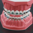 thumbnail image 5 of Dentalmall Typodonts Modelo de demostración de ortodoncia con alambres de metal y soporte Modelo de interpretación de enseñanza aprendizaje para adultos y niños (soporte de metal), 5 of 5