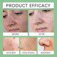 thumbnail image 2 of Green Tomato Clay Mask, Green Tomato Clay Mask Cleanser for Deep Cleansing, Oil Control and Pores Purifying, Brighten, Blackheads Dirts Removal, 2 of 5