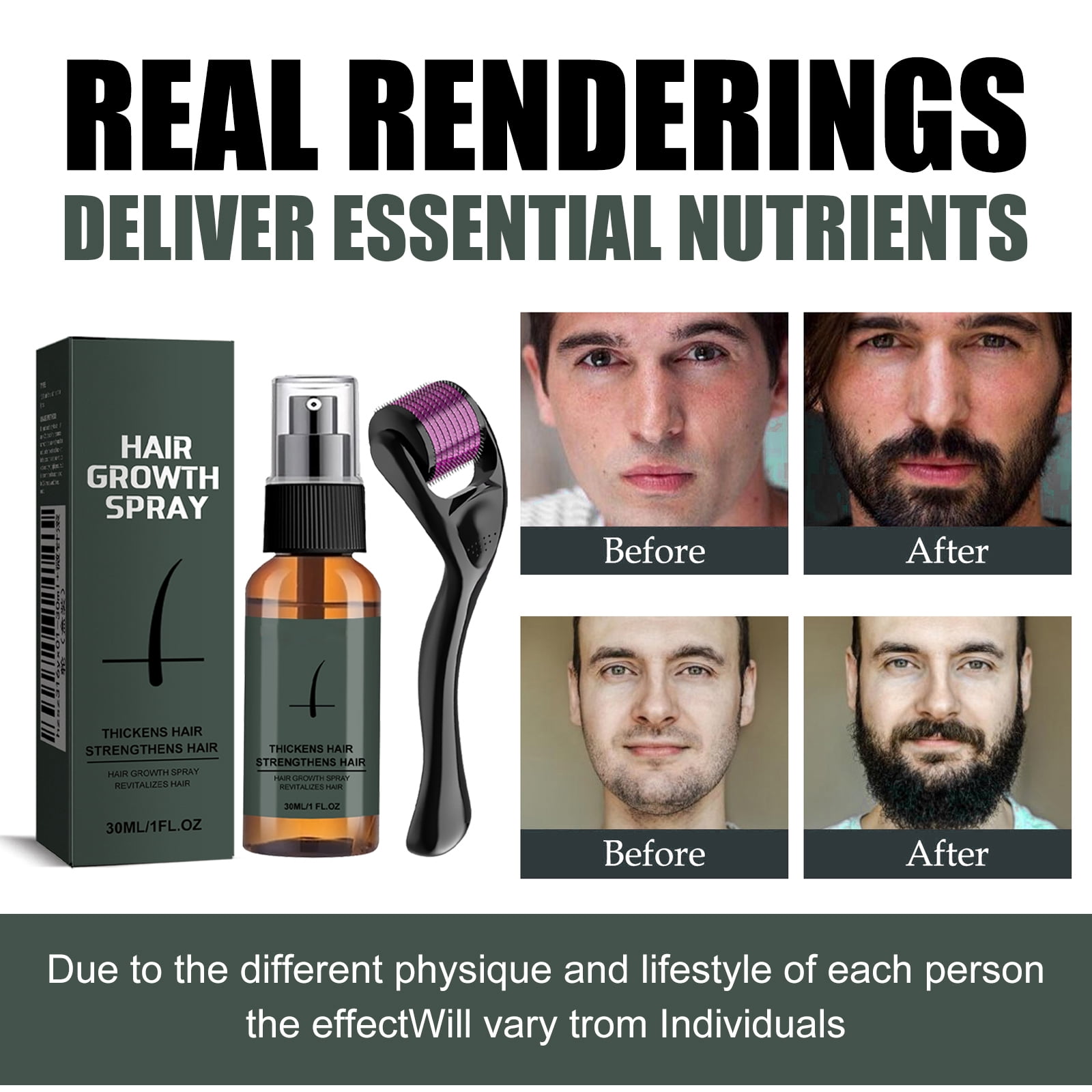 Alvantor Beard Growth Kit, Beard Oil Beard Care for Men, 1fl.oz