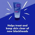 thumbnail image 4 of Clean & Clear Exfoliant Élimine points noirs Advantage, 141g, 4 of 5