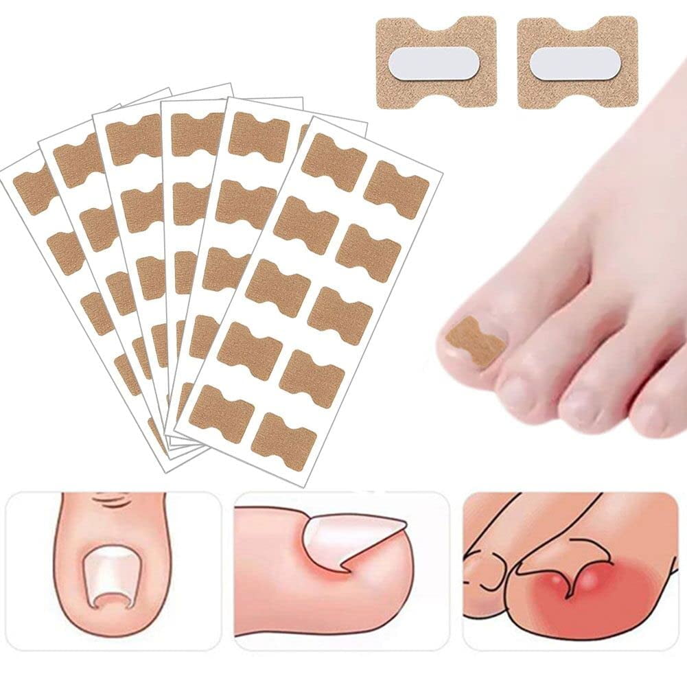 Fongwan Toenail Correction Stickers Ingrown Toenail Corrector Strips Corrective Toenail Stickers