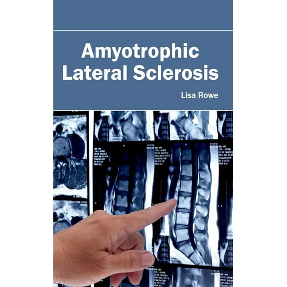 Amyotrophic Lateral Sclerosis, (Hardcover)
