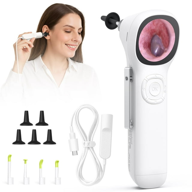 ScopeAround Otoscope with Light, 720P HD Ear Cleaning Camera & 6 LED Lights Ear Scope, 1.45" IPS Display Digital Otoscope, Ear Scope with Extention Cable,