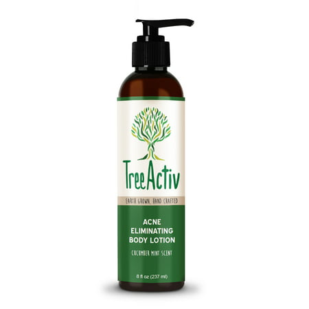 TreeActiv Acne Eliminating Body Lotion, Bacne Salicylic Acne Treatment, Cucumber Mint Scent (Best Acne Treatment For Back And Shoulders)