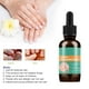 thumbnail image 4 of Solución líquida antimicótica para uñas de 30ml para uñas de manos y pies, 4 of 5