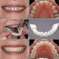 thumbnail image 2 of A Pair Upper Lower Perfect Quality Denture Instant Smile Comfort Fit Flex Cosmetic Teeth Denture Teeth Top Cosmetic Veneer, 2 of 2
