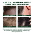thumbnail image 5 of Productos para el cuidado del cabello Champú antipicazón Hair Moss Limpieza del cuero cabelludo Anticaspa Control de grasa capilar Antipicazón Refrescante Reparación 100 ml un champú, 5 of 5