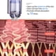 thumbnail image 2 of Lot de 10 cartouches remplaçables pour aiguilles Derma pour stylo de microneedling, cartouche 36 broches, 2 of 4