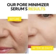 thumbnail image 4 of Sérum LANBENA, minimizador y reductor de poros para rostro, 15 ml, 100% vegano, 4 of 8