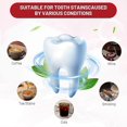 thumbnail image 4 of ExquisiteSp-14 Toothpaste, Probiotic Toothpaste Sp-14, Sp-14 Whitening Toothpaste, Fresh Breath and Stain Removal, Improve Oral Health, 4 of 5