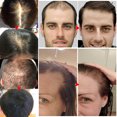 thumbnail image 3 of IBeaLee Dense Hair Nourishing essence Moisturizing Hair Dense Hairline Strong Firm Hair Loss Prevention Care Oil, 3 of 4