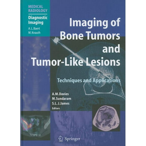 Imaging of Bone Tumors and Tumor-Like Lesions: Techniques and Applications, (Hardcover)
