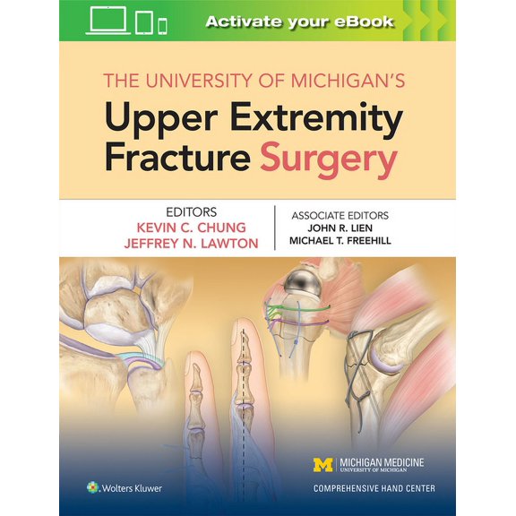 The University of Michigan's Upper Extremity Fracture Surgery (Hardcover)