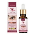 Vitamin E Hydration Nourishment Eye Stye Remover Stye Eye Chalazion Remover For Styes Chalazion