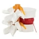 thumbnail image 3 of Modelo de demostración de columna vertebral lumbar Jadeshay 1:1.5 Hernia de disco lumbar humano, 3 of 8