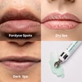 thumbnail image 4 of Crema de labios ABERA Abera Fordyce con HPR para labios secos, 20 ml, 4 of 7