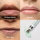 thumbnail image 4 of Crema de labios ABERA Abera Fordyce con HPR para labios secos, 20 ml, 4 of 7