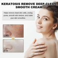 thumbnail image 2 of Deep Cleansing Smooth Cream Cleansing Skin Acne Cutin Dredging Pores Hydrating Tend, 2 of 4