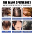 thumbnail image 4 of Ginger Hair Growth Spray Scalp Massage Moisturizing Thick Hair Hair Care Nutrition Spray -, 4 of 4