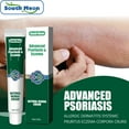 Eczema Cream Maximum Strength Treatment Ointment For Rash Psoriasis don-t-ignore-these-scarlet-fever-warning-signs-scarlet-fever-rash