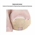 thumbnail image 4 of Pedicure Tools - Ingrown Toenail Corrector Stickers For Paronychia Recovery, 4 of 5