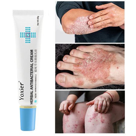 Herbal Anti-microbial Cream Antipruritic Eczema Dermatitis Eczema Relief Natural Lithospermum Body Skin Care Repair Improve Skin