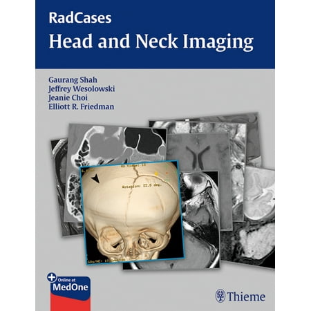 UPC: 9781604061932 | Radcases Plus Q&A: Radcases Head and Neck Imaging (Paperback)