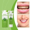 thumbnail image 3 of Pasta de dientes blanqueadora, pasta de dientes con aloe vera que blanquea los dientes y elimina las manchas amarillas. Protege el esmalte dental y promueve la salud dental. 100 g por crema., 3 of 5