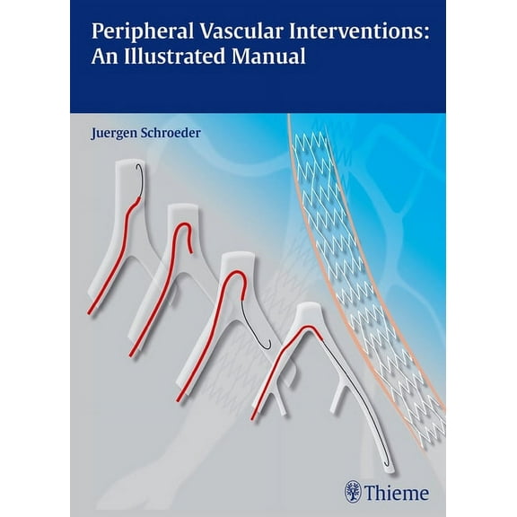 Peripheral Vascular Interventions: An Illustrated Manual, (Hardcover)