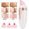 thumbnail image 5 of Blackhead Removal Machine, Househould Strong Suction Pore Cleaner Beauty Instrument Vacuum Cleaner For Facial Skin Deep Cleansing, 5 of 5