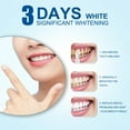 thumbnail image 5 of Discount Bonanza, Flawles Teeth Whitening Pen, Gel Pen, Stain Remover, Breath Freshener, Oral Care, Dental Beauty, For Daily Use Up to 30% OFF | Plastic, Multicolor, Acppild, 5 of 8