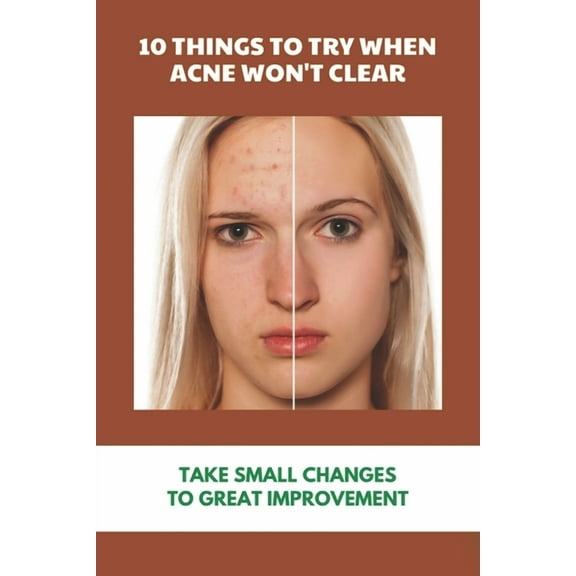 10 Things To Try When Acne Won't Clear: Take Small Changes To Great Improvement: Holistic Ways To Eliminate Acne (Paperback)