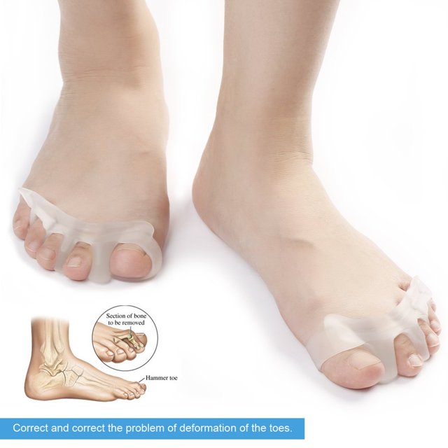 Separador de dedos de silicona BANYUO para cuidado de pies Corrector de Hallux Valgus 2 piezas