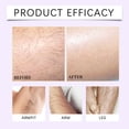 thumbnail image 7 of SZBAOAN 3 In 1 Hair Removal Cream with Scraper Smooth Hair Removal Sp Set,Painless Depilatory Sp For Women & Men,Hair Remover for Legs,Arms,Underarms, 7 of 7