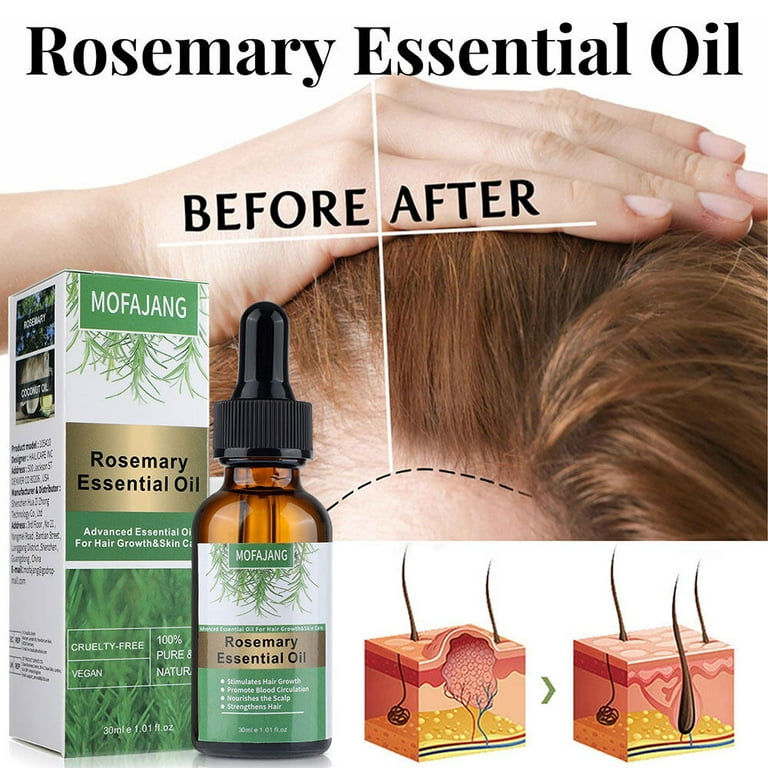 Rosemary Essential Oil for Hair Growth, Pure Natural Rosemary Hair Care Oil  Nourishes Scalp Prevents Hair Loss Rid of Itchy & Dry Scalp, Rosemary Hair