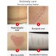 thumbnail image 4 of Gel reparador de cicatrices de acnéquemadurasespinillasestríasungüento para eliminar el cuidado de la piel, 4 of 6
