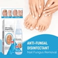 thumbnail image 3 of Anti-Fungal Disinfectant Spray for Nail Fungus Removal, Fast-Acting Solution, Eliminates Odor, 100ml Bottle, Safe for Daily Use, 3 of 8
