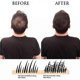 thumbnail image 3 of Immetee Hair Building Fibers for Thinning Hair Regrowth Your Hair Instantly Thickener for Fine Hair 28g, 3 of 4