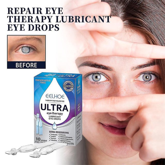 Tratamiento de cataratas, gotas para los ojos, picazón seca en los ojos, cuidado de la fatiga, alivio de la visión borrosa, tratamiento del enrojecimiento de los ojos, gota para mejorar la vista