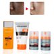 thumbnail image 5 of Hidrata, nutre, controla la grasa y elimina los puntos negros: la solución definitiva para el cuidado de la piel Cuidado hidratante 4 en 1 para hombres, 5 of 8