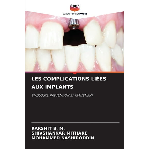 Les Complications Liées Aux Implants, (Paperback)