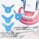 thumbnail image 1 of Regla de medición de diastema dental, 4 piezas/juego Regla de diastema dental Regla de diastema de máxima eficiencia, 1 of 9