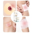thumbnail image 2 of 30ML Colostomy Adhesive Wipe-off Spray Medical Adhesive Remover Care, 2 of 6