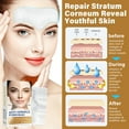 thumbnail image 5 of Anti Wrinkle Patches, Forehead Wrinkle Patches, Smooth Fine Lines & Wrinkles, Reduces Fine Lines & Frown Lines, 10PCS, 5 of 8