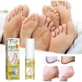 thumbnail image 2 of Spray exfoliante para pies en aerosol, crema para pies y cuidado de la piel, 2 of 5