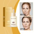 thumbnail image 4 of El tratamiento facial blanco puede resistir eficazmente el envejecimiento e hidratar durante mucho tiempo (30 ml), 4 of 4